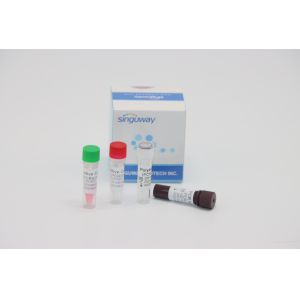 China Quantitative Molecular Diagnosis RT PCR Test Kit Real Time For HPV Tox Virus on sale