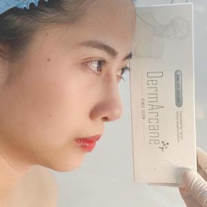 China koreaDermArcane dermal filler gel injections buttocks enlargement Hyaluronic acid factory