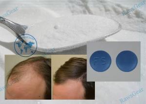 China Hot Sale Finasteride Powder Large Stock Help Improve Hair Loss Low Price Made In China 98319-26-7 on sale