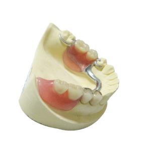 China Steel Removable Partial Dentures Denture Restoration Dental Lab Products factory