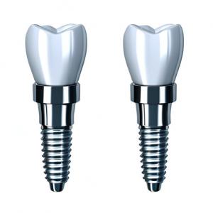 China Consistency In Every Crown Our Dental Implant Crown Manufacturing Process factory
