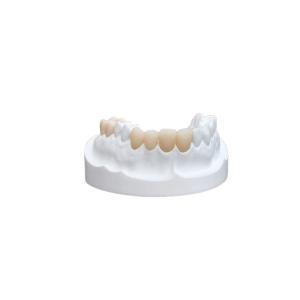 China Inlays Onlays Ceramic Dental Crown Strong Veneer For Dental Department on sale
