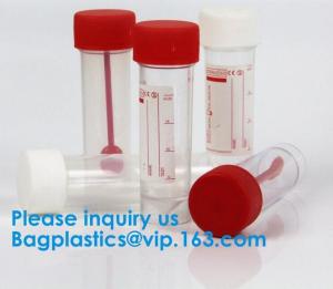 China Disposable Urine Specimen Cup/Urine Sample Containers/Urine Collection Cup,Sterile Disposable Hospital Sample 60ml 100 factory