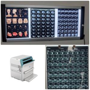 China Blue Medical X Ray Films Compatible Fuji Drypix  Lyte 2000 3500 Printer DIHT 8X10 For DR CT MRI Image factory
