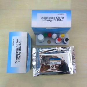 China odm Elisa Diagnostic Kit For Hepatitis B Virus Surface Antigen on sale