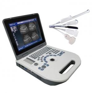 China 12.1 Inch Laptop Ultrasound Machine OB Diagnostic System For Home Use on sale