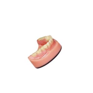 China Denture Dental lab PFM Dental Bridge 3D Digital Intraoral Scanning Imaging System factory