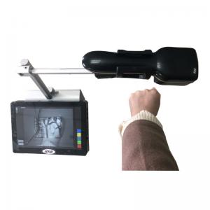 China Portable Economical Infrared Vein Finder Detecting About 10mm Depth of Vein Trolley Available on sale