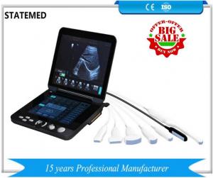 China Digital Portable Echocardiography Machine Ultrasound Machine For Pregnancy factory