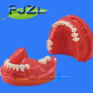 China dental model for partial denture restorative factory