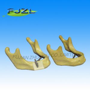 China dental implant manufacturers supply dental drill model factory