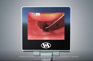 China Ambulance ENT Medical Video Laryngoscope For Intubation 1280*720 Px on sale