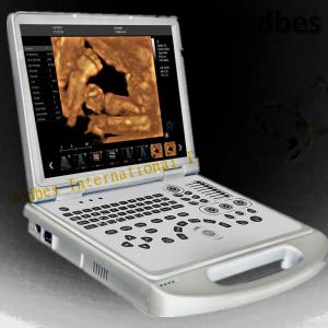 China 4D Baby Portable Medical Color Doppler Ultrasound Machine on sale