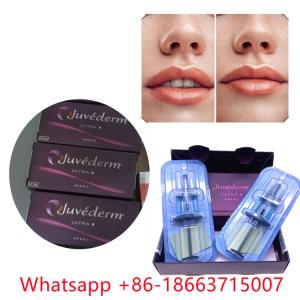 China Juvederm Ultra 4 (2x1ml) Injectable Dermal Filler Lip Enlargement factory