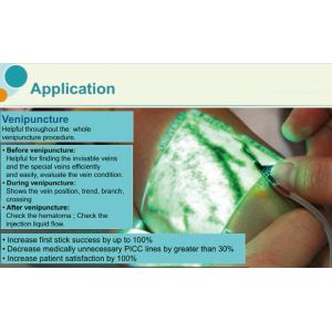 Injection Light Ems Health Analyzer Machine , Handheld Vein Locating Device