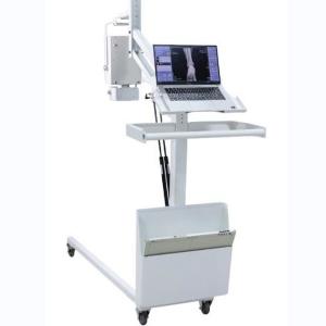 China High Frequency Mobile Digital Radiography Machine Digital X Ray Equipment factory