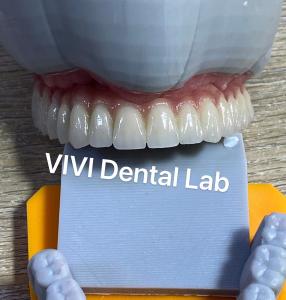 China Translucency Digital Dental Crowns Teeth High Esthetics Customized factory