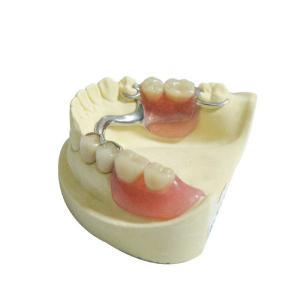China CE Dental Lab Products Replacements Plastic Removable Partial Dentures factory