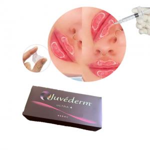 China Juvederm Ultra3 Hyaluronic Acid Dermal Filler Lip Enhancement on sale