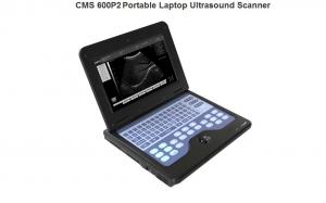 CMS600P2 VET Veterinary Ultrasound Scanner Machine+7.5mhz Rectal probe,SALE!!