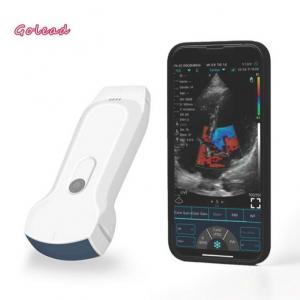 China 3 in 1 Wireless Ultrasound Probe with 8 Adjustment TGC WiFi Connection factory